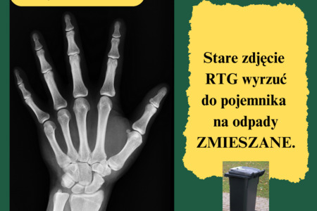 Gdzie wyrzucić stare zdjęcie RTG? [RADZIMY]